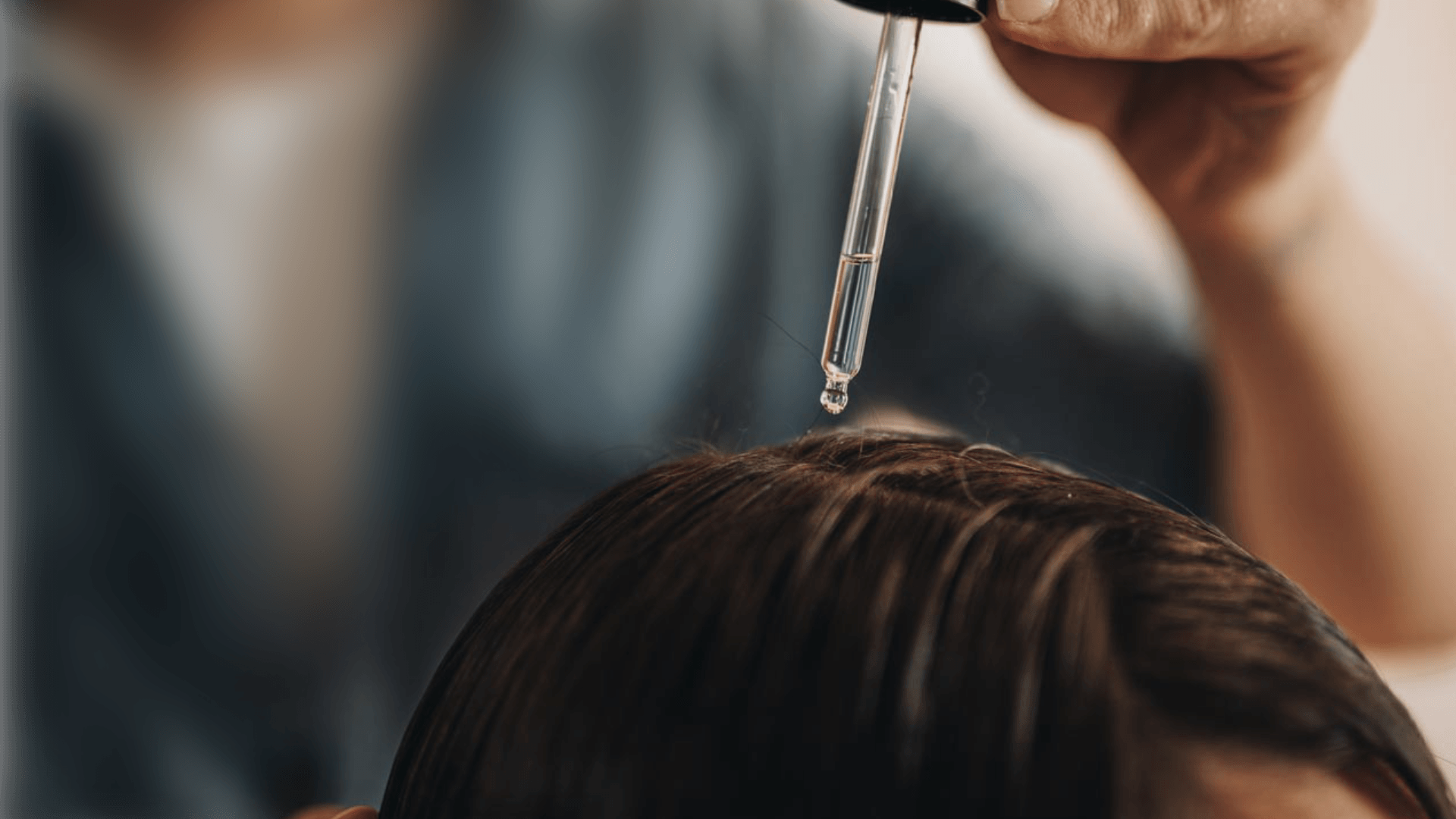 topical-applications-for-hair-loss